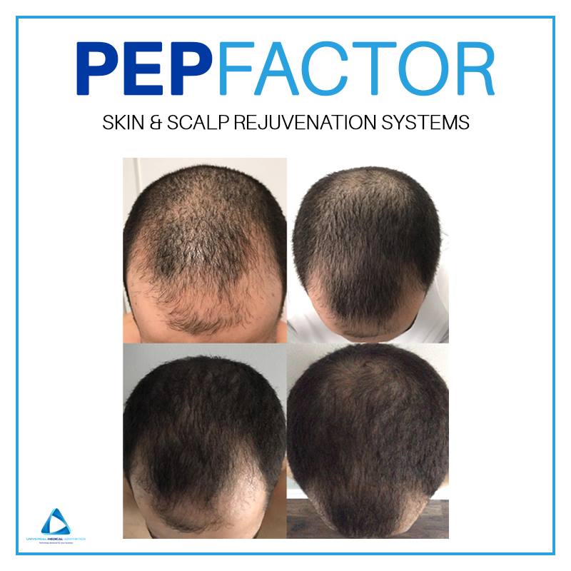 Pep Factor In Salon System Angela s Mane Attraction Kew